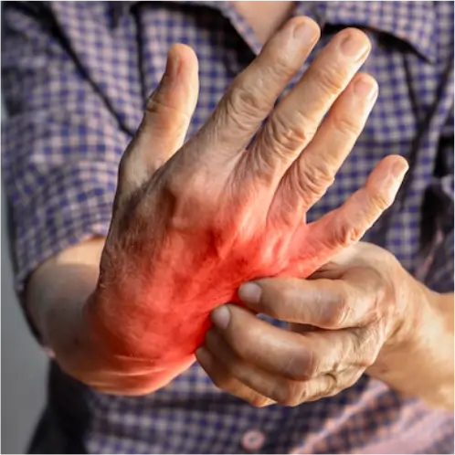 Tratamiento con exosomas para artrosis y artritis en Vitaconciencia, Bogotá